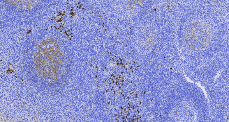 CD15(MMA),MMab