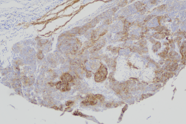 CD56(C6E9),MMab