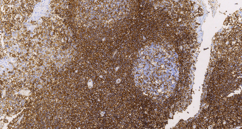 CD44(MRQ-13),MMab