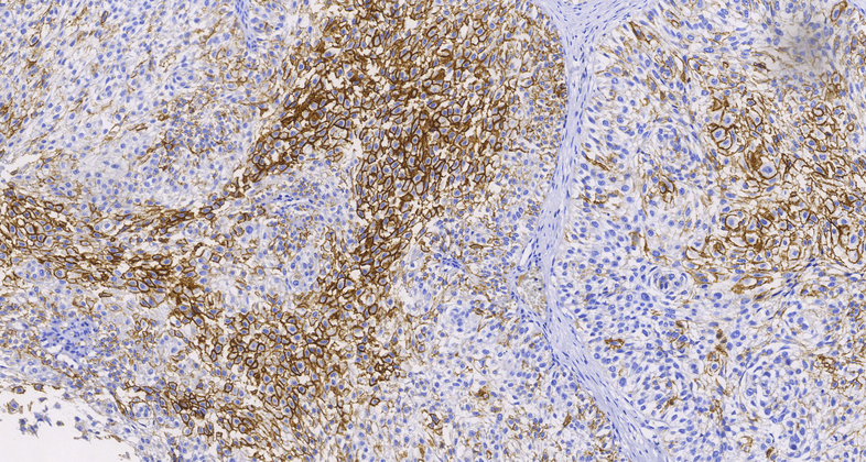 CD44(MRQ-13),MMab
