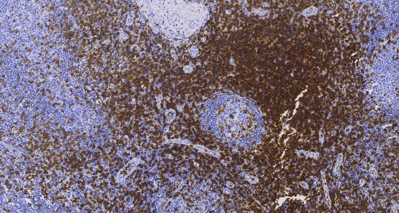 CD5 (C6A10), MMab