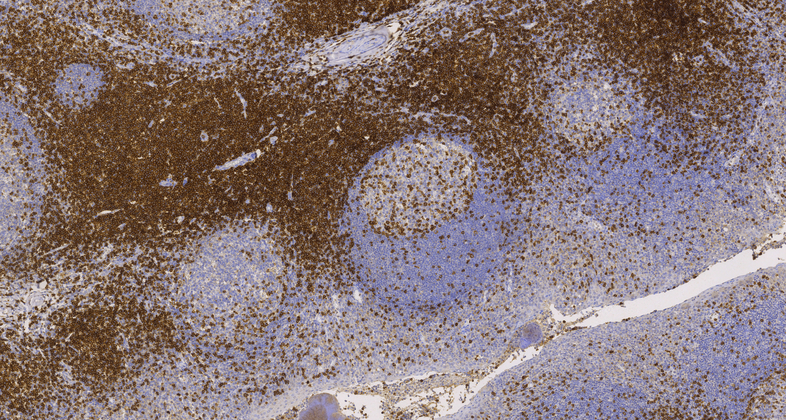 CD7(MRQ-56),MMab