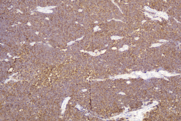 CD99(C1G2),MMab