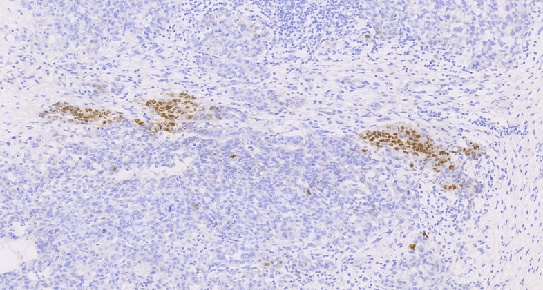 Brachyury(RBT-TBXT),RMab