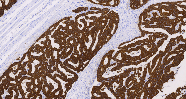 Cytokeratin 8(C7E10),MMab
