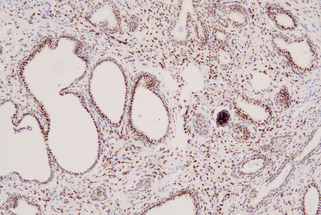 Androgen Receptor(C1B4),MMab