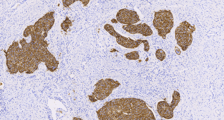 Desmoglein-3(EP306),RMab