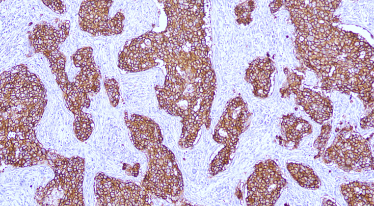 TRPS1(EPR16171),RMab