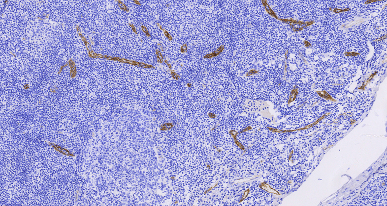 Factor VIII(36B11),MMab