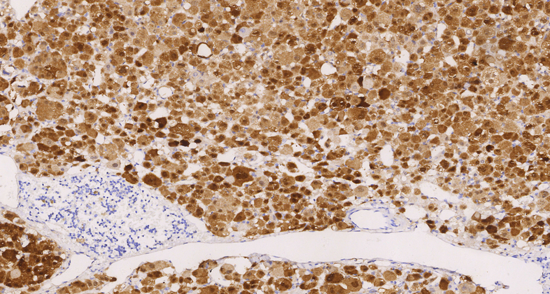 Calretinin(C5G4),MMab