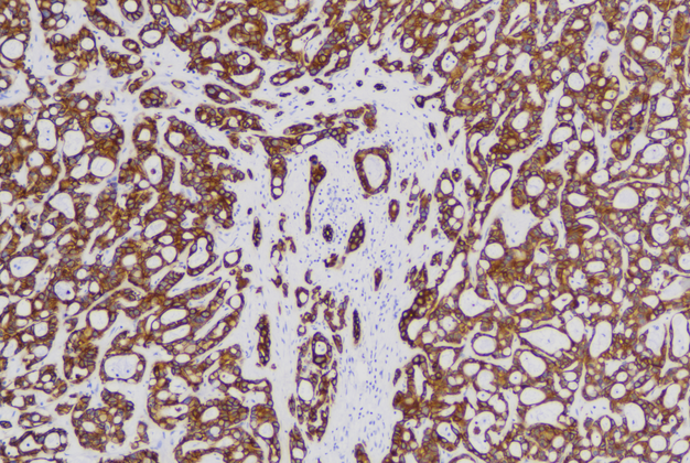Cytokeratin8/18(C7E10/C6B9), MMab