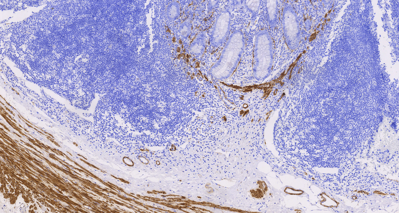 Calponin (C6A12), MMab