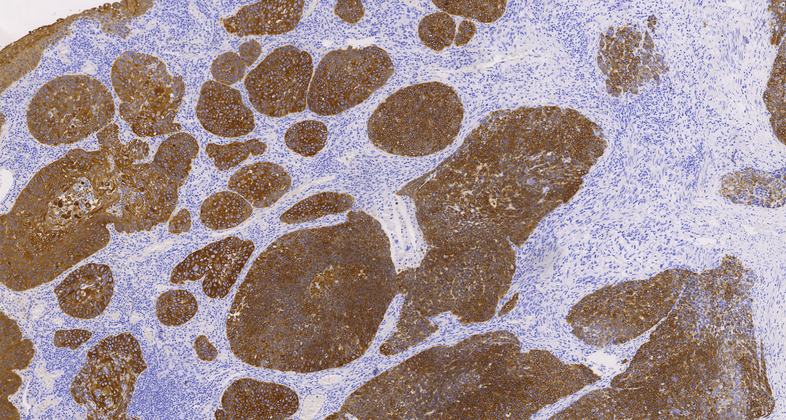 Cytokeratin Pan (AE1/AE3),MMab