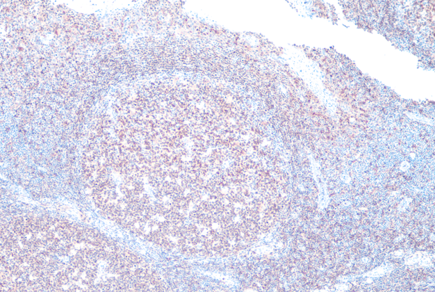 CD74(LN2),MMab