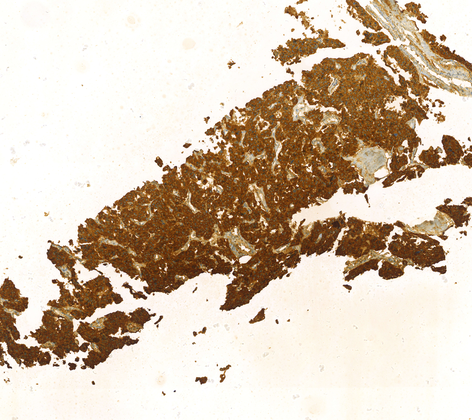 Calcitonin(polyclonal),RPab