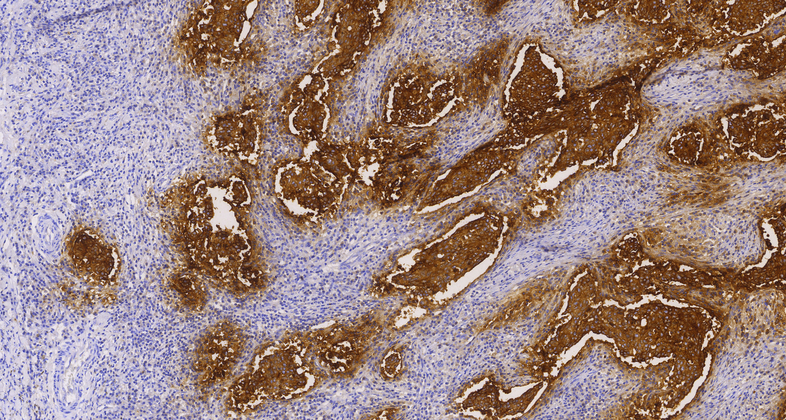 CEA (C3G5), MMab
