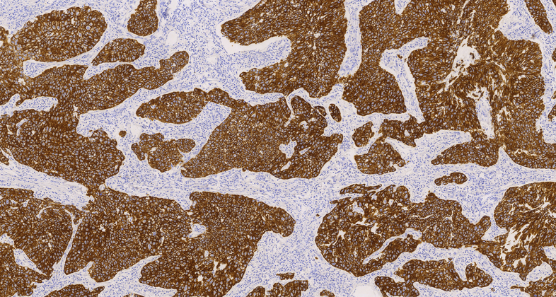 Cytokeratin 7(OV-TL 12/30),MMab