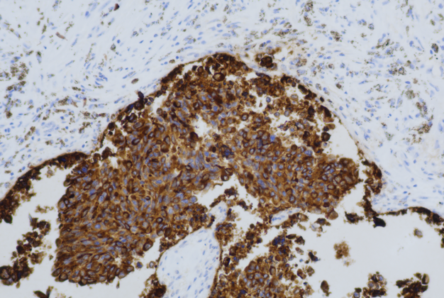 Calcitonin(C1C2),MMab