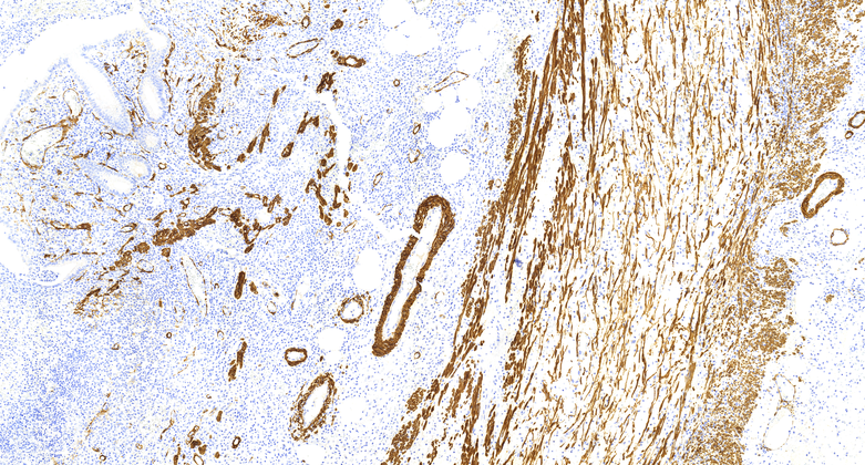 SMA (C1C1), MMab
