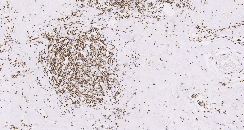 ERCC1(EP219),RMab