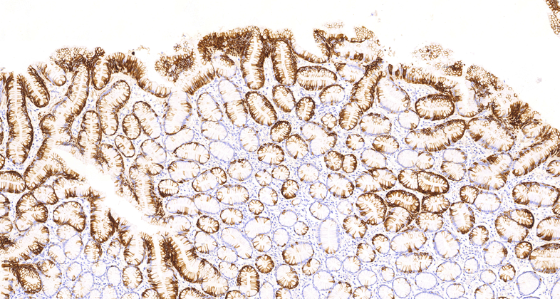 Cytokeratin 20 (C7C11), MMab