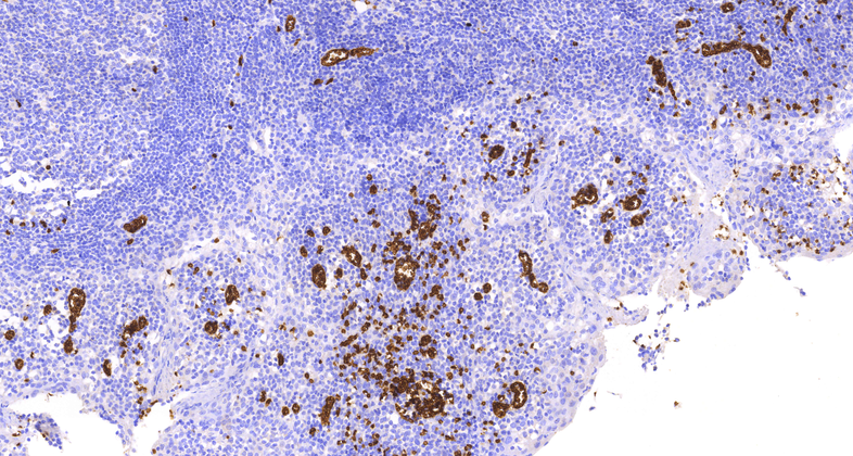 Glycophorin A,CD235a(JC159),MMab