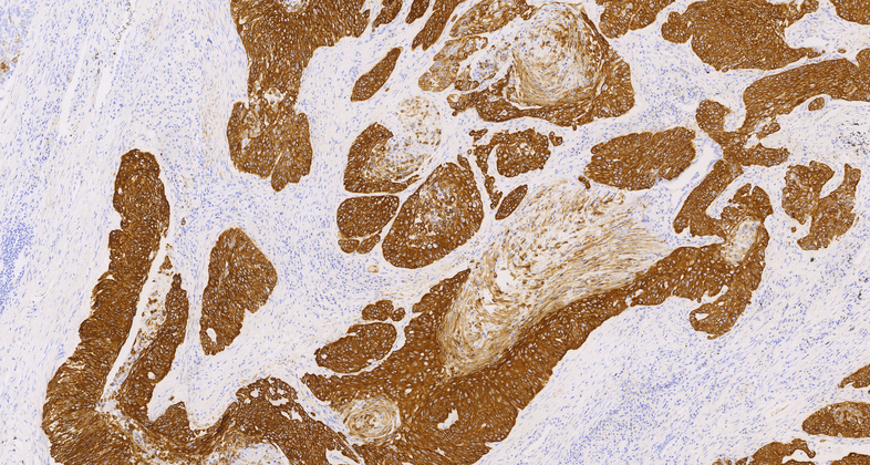 Cytokeratin14(LL002),MMab