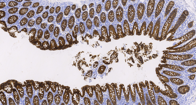 Cadherin 17(SDT-R151),RMab