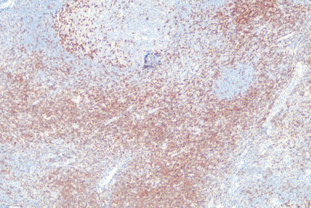 CD2 (C3G8), MMab