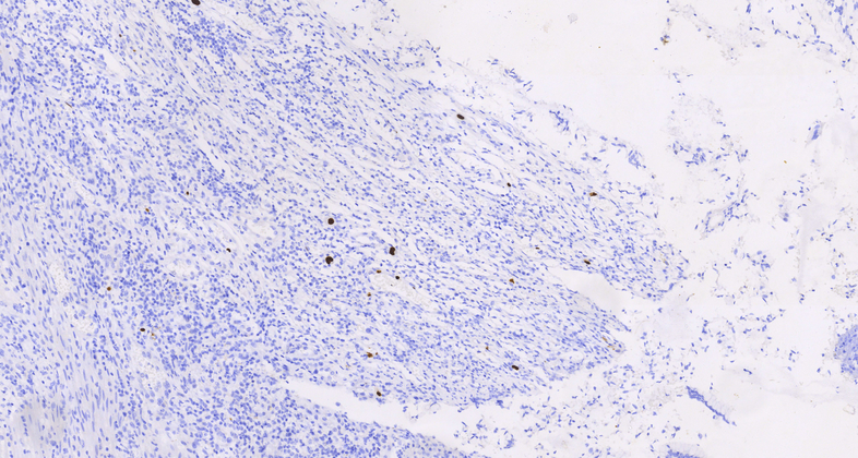Cytomegalovirus(8B1.2,1G5.2 & 2D4.2), MMab