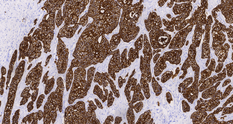 Cytokeratin LMW(AE1),MMab