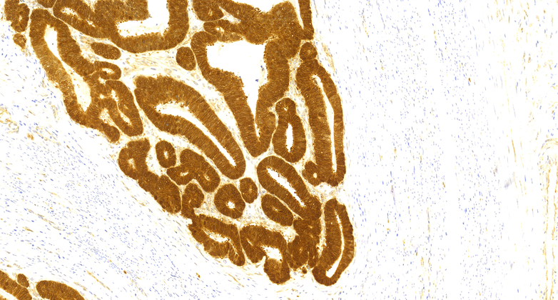 β-Catenin(MyR1-CTNNB), RMab