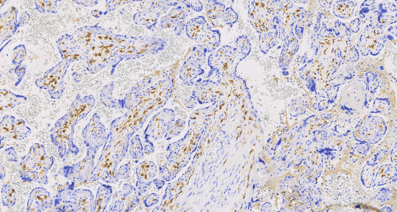 Factor  XIIIa(EP3372), RMab