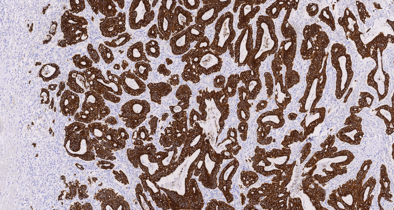 Cytokeratin18(DC-10),MMab
