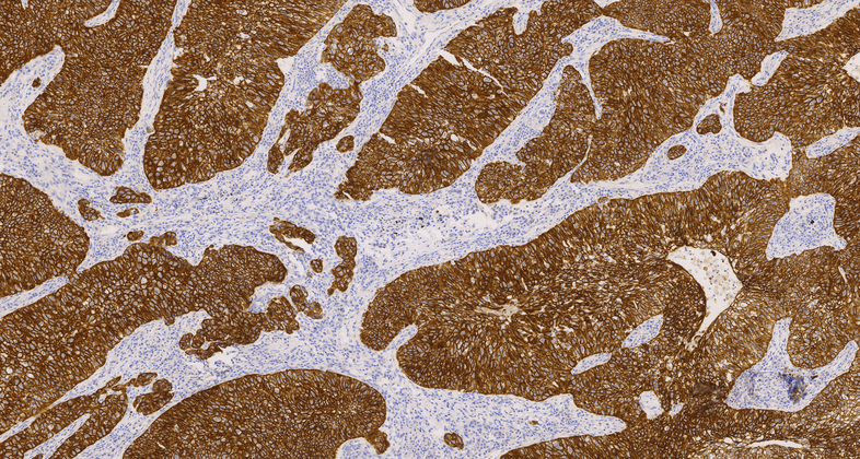 Cytokeratin 7 (C1C10),MMab
