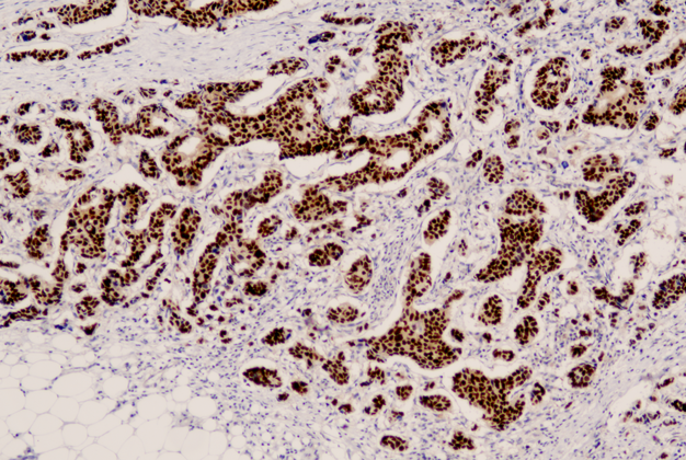 Estrogen Receptor(C6H7),MMab