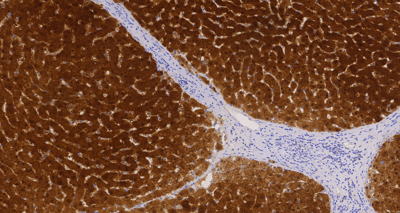 Arginase-1(EP261),RMab