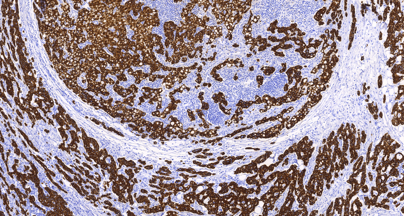 Cytokeratin 8/18 (B22.1 & B23.1), MMab