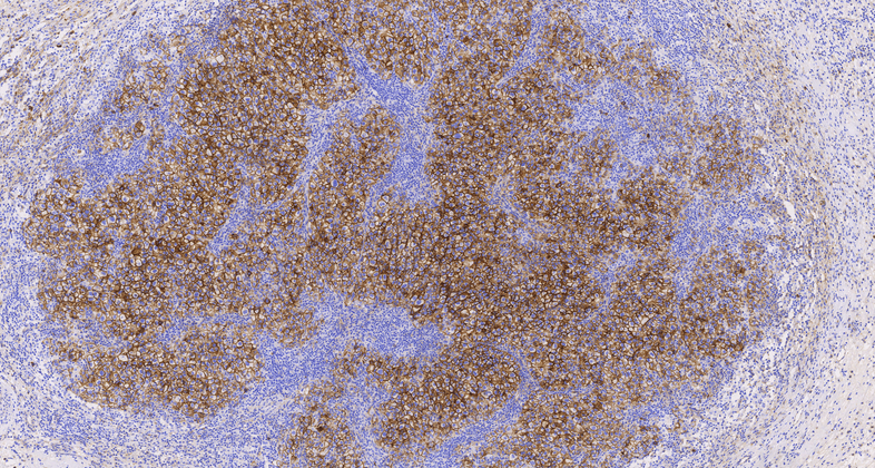 CD138(C5G6),MMab