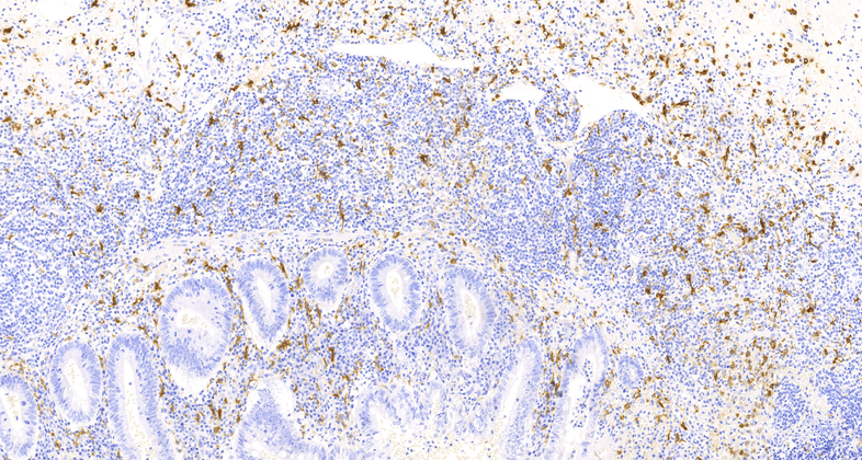 CD163(10D6),MMab