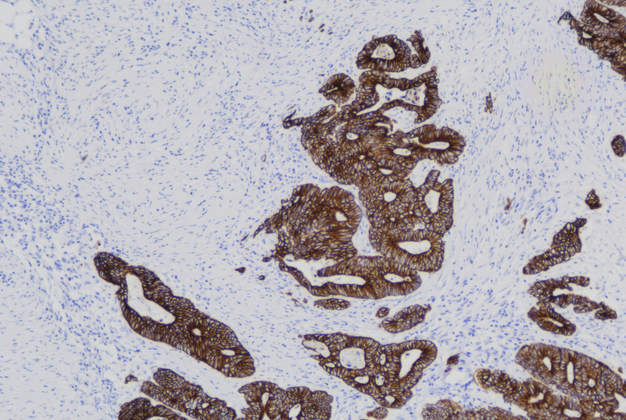 Cytokeratin (C4E1),MMab