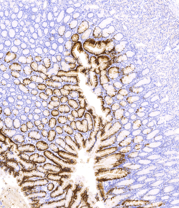 Cytokeratin 20(Ks20.8),MMab