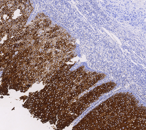 Cytokeratin10&13(DE-K13),MMab