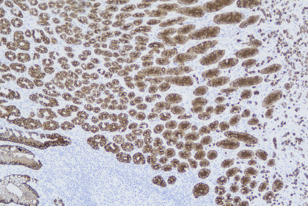Cytokeratin18 (C6B9), MMab