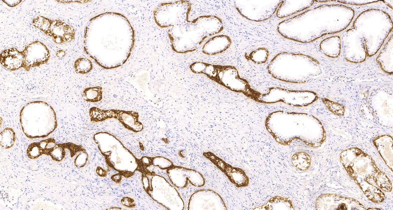 Cytokeratin HMW (34βE12), MMab