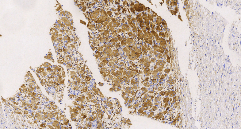 Cathepsin K(3F9), MMab