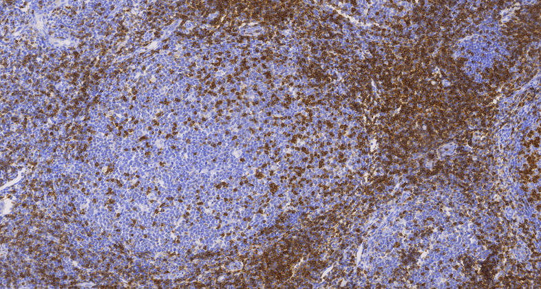 CD2 (EP222), MMab