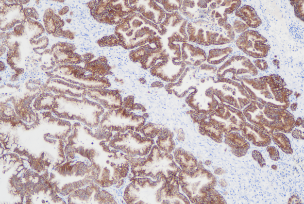ALK(C4X1),RMab