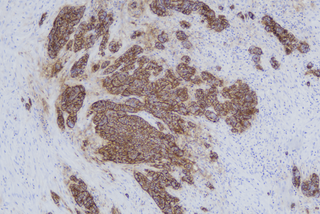 CA125(C6E8),MMab