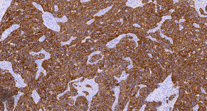 Cytokeratin 19(A53-B/A2.26),MMab